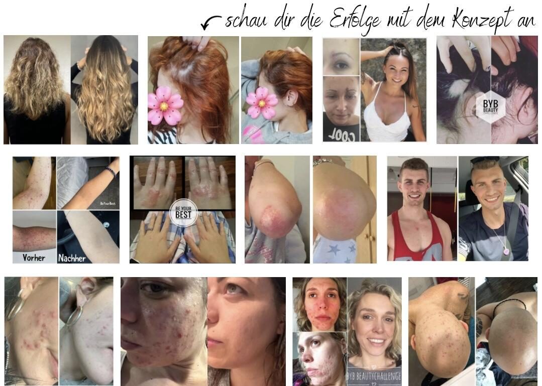 Veränderungen mit dem Konzept – Haut, Haare und mehr